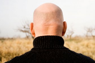 Назван напиток, который защищает мужчин от облысения