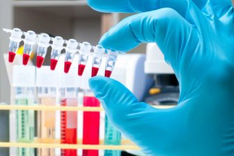 Новый метод определения допинга может быть внедрён к Олимпиаде-2020