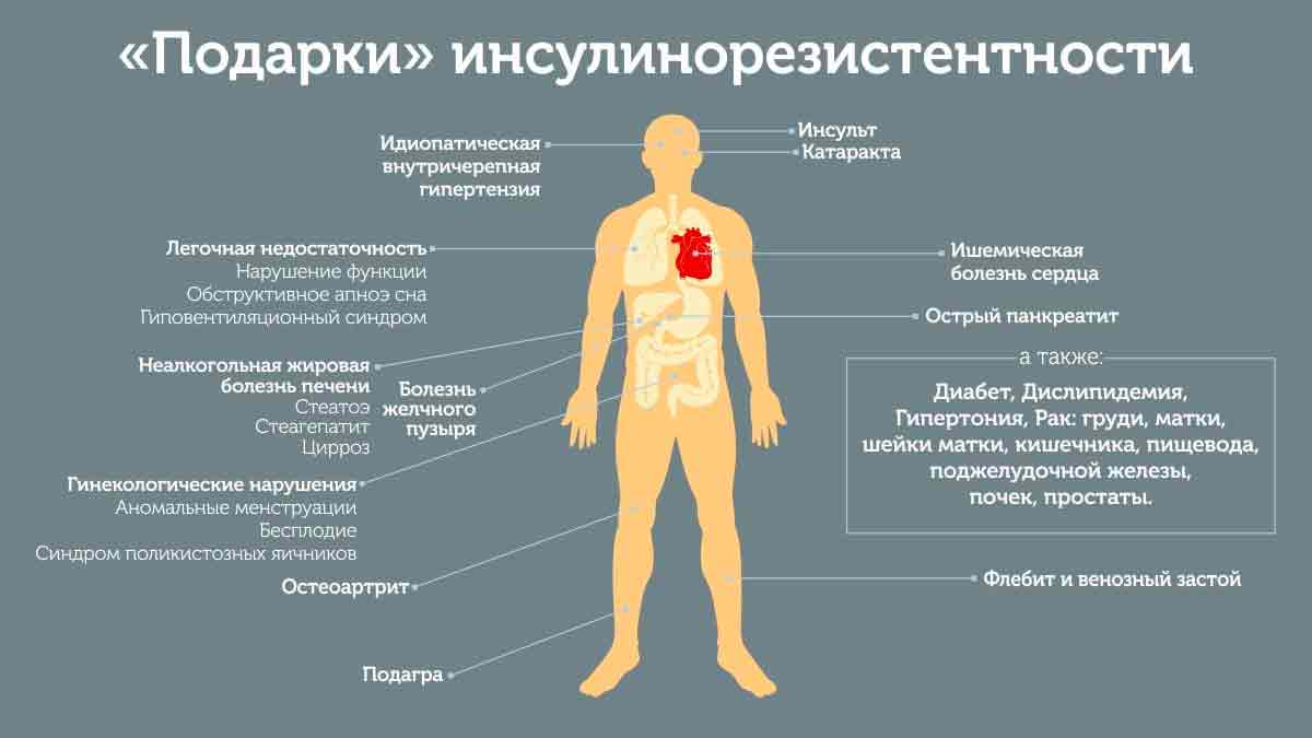 Инсулинорезистентность - что значит быть инсулинорезистентным? Причины, симптомы и лечение